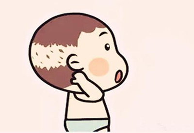 母乳检测仪厂家介绍婴儿枕秃怎么办